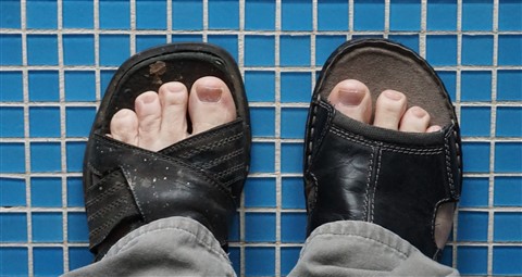 mismatched flipflops dumbass